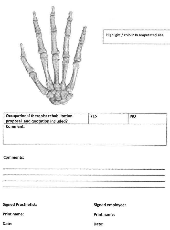 N149 Partial Hand Prothesis (2)